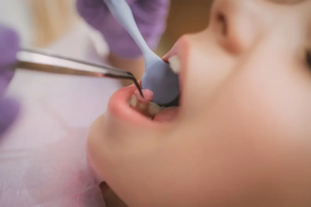 Channel Islands Family Dental Office | Dentist In Ventura County