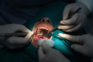 closeup-dentist-and-assistant-operating