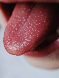 tongue