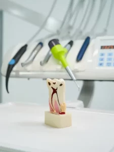 close-up-of-tooth-model-with-root-canals-and-caries