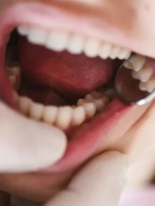 open-mouth-examination