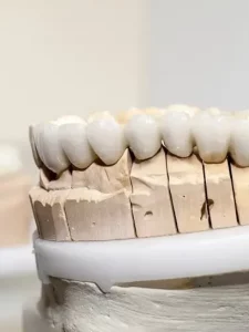 model-of-teeth-close-up