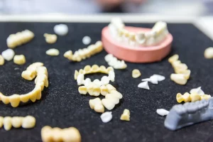 denture-treatment-prosthetic-dentistry-implants