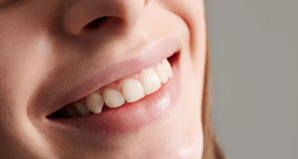 How Long Does It Take for the Wisdom Tooth Hole to Close?