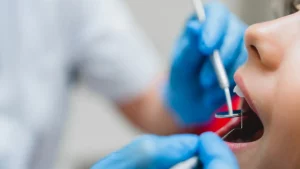 operating-teeth-tooth-filling-mouth-cavity