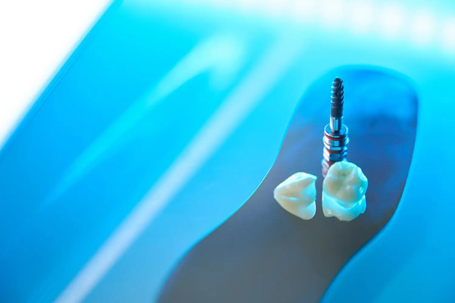 photo-of-teeth-and-dental-pin-for-restoration