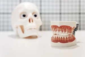 dental-models