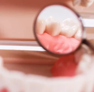 white-teeth-in-mirror