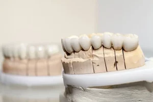 model-of-teeth-close-up