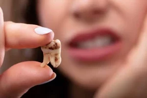 ¿Cuántos dientes tienen los adultos?