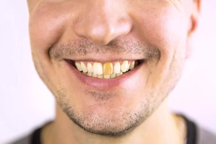 what is tooth enamel