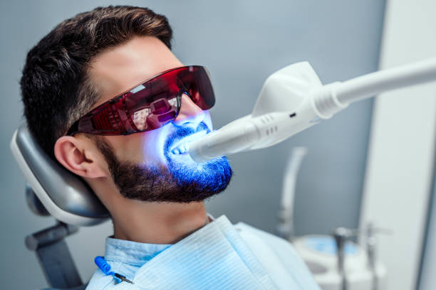 laser tooth whitening