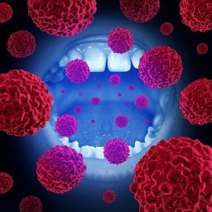 mouth-with-bacteria