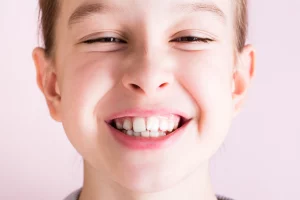 Niño con los dientes torcidos o apiñamiento dental
