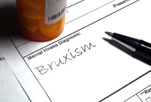 bruxism-written-on-a-paper-min