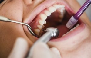 dentist-performing-a-dental-cleaning