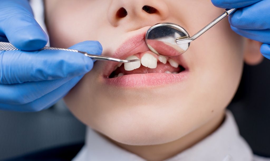 Channel Islands Family Dental Office | Dentist In Ventura County