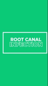 root canal infection