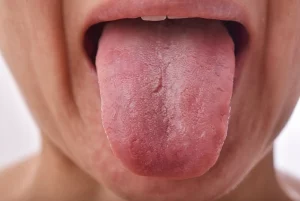 man-with-tongue-disease