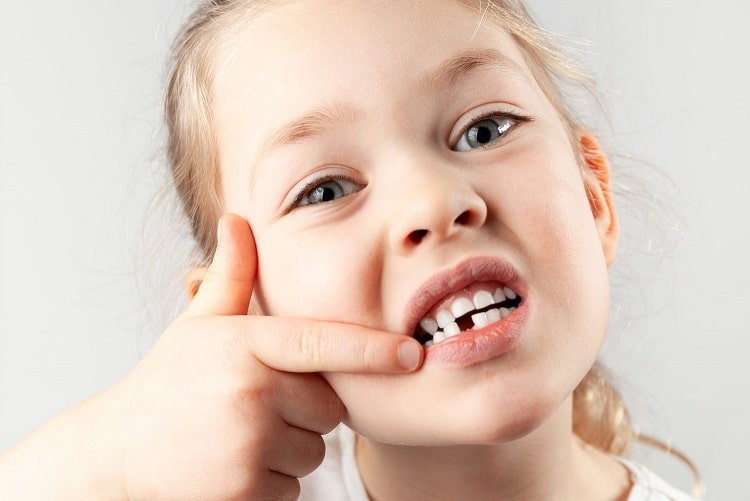 kid-showing-her-teeth