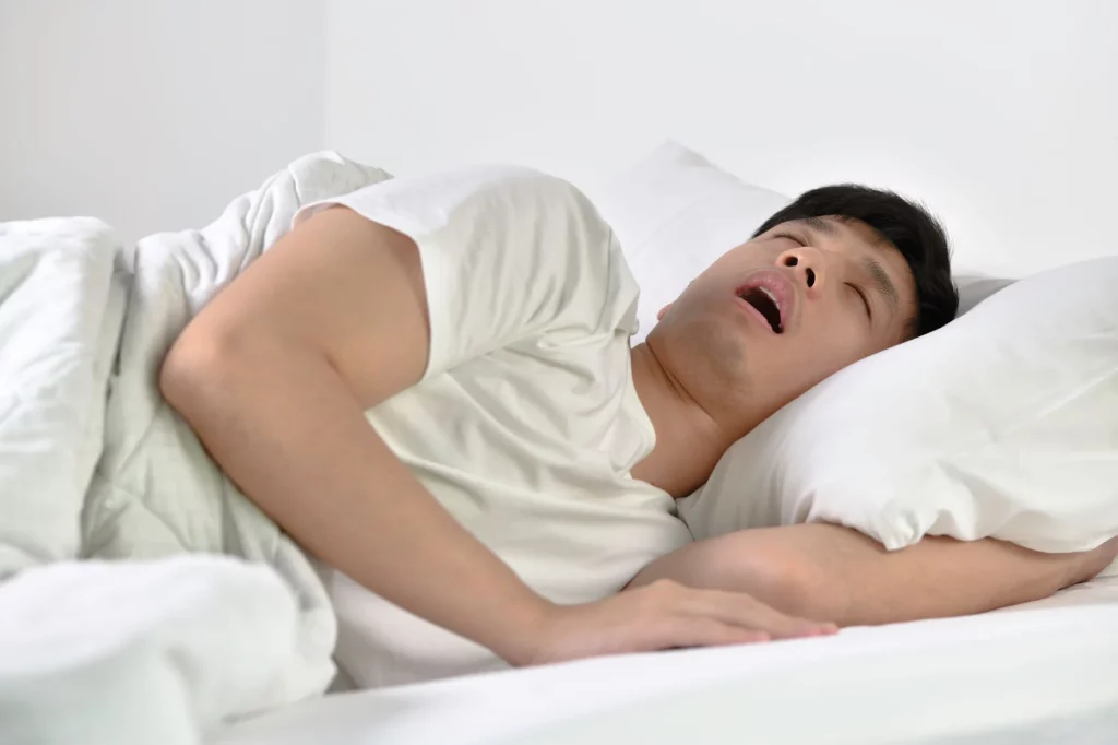 Apnea del sueño