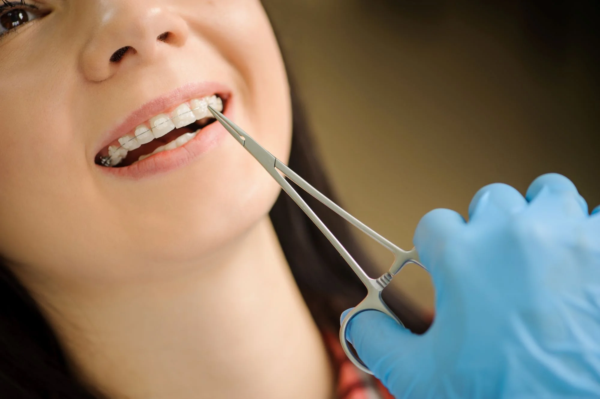 Brackets Transparentes