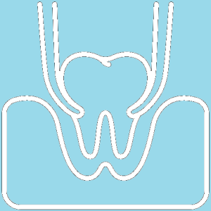 Dental Extraction - Channel Islands Family Dental