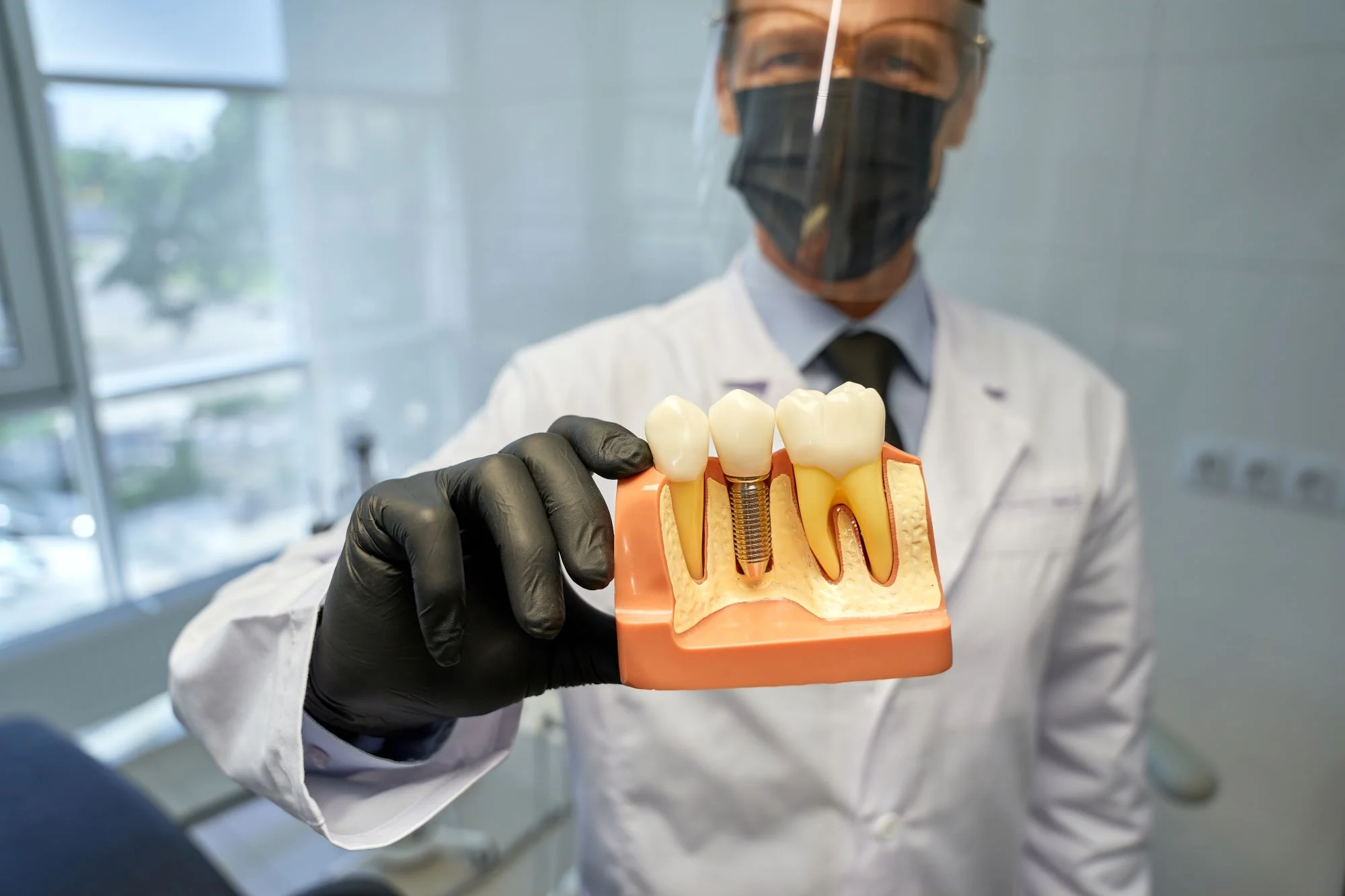 Los Mejores Implantes Dentales En Santa Paula