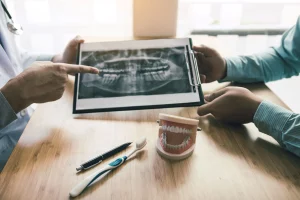 Radiografías dentales vs panorámicas