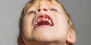 loose teeth and gum disease