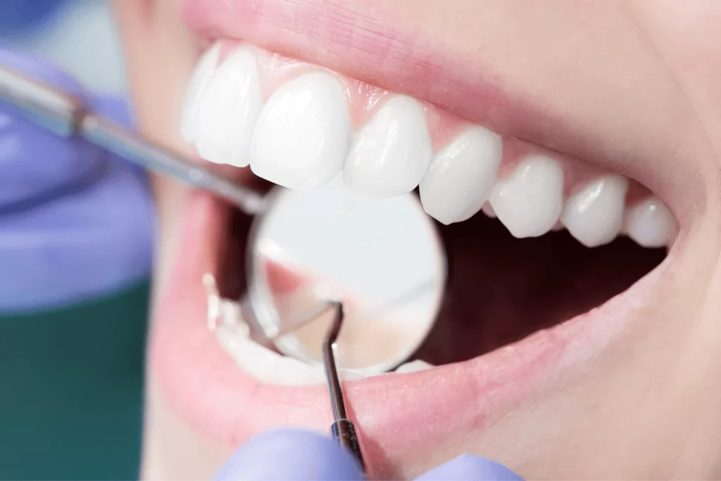 Channel Islands Family Dental Office | Dentist In Ventura County