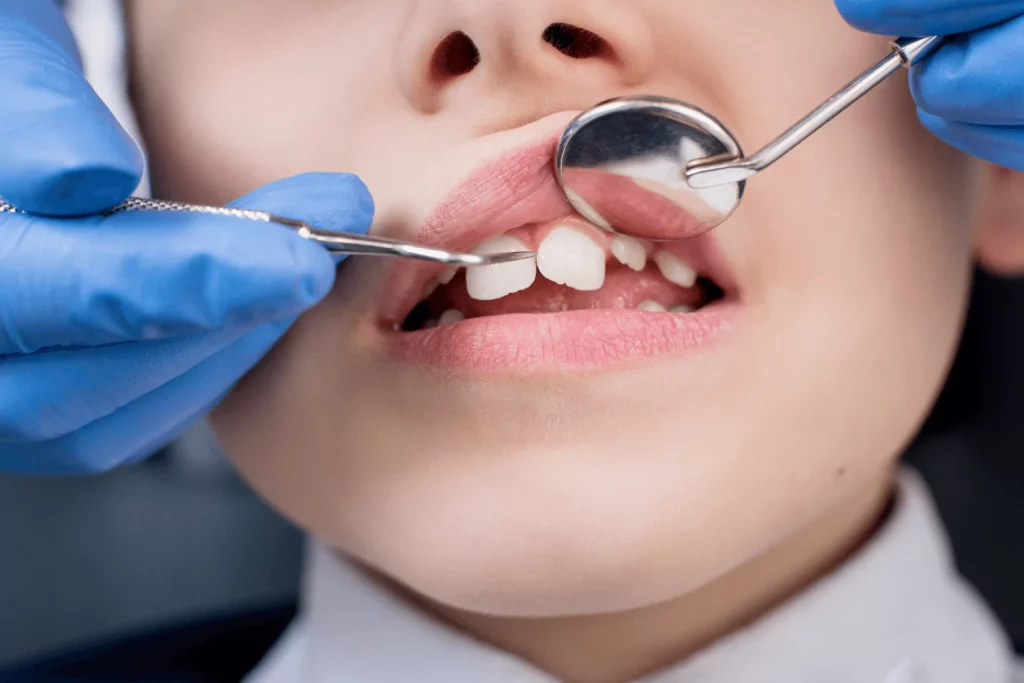 Channel Islands Family Dental Office | Dentist In Ventura County