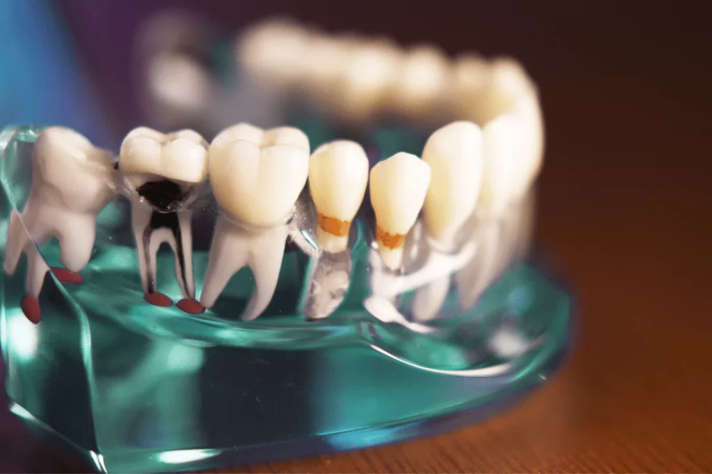 Channel Islands Family Dental Office | Dentist In Ventura County