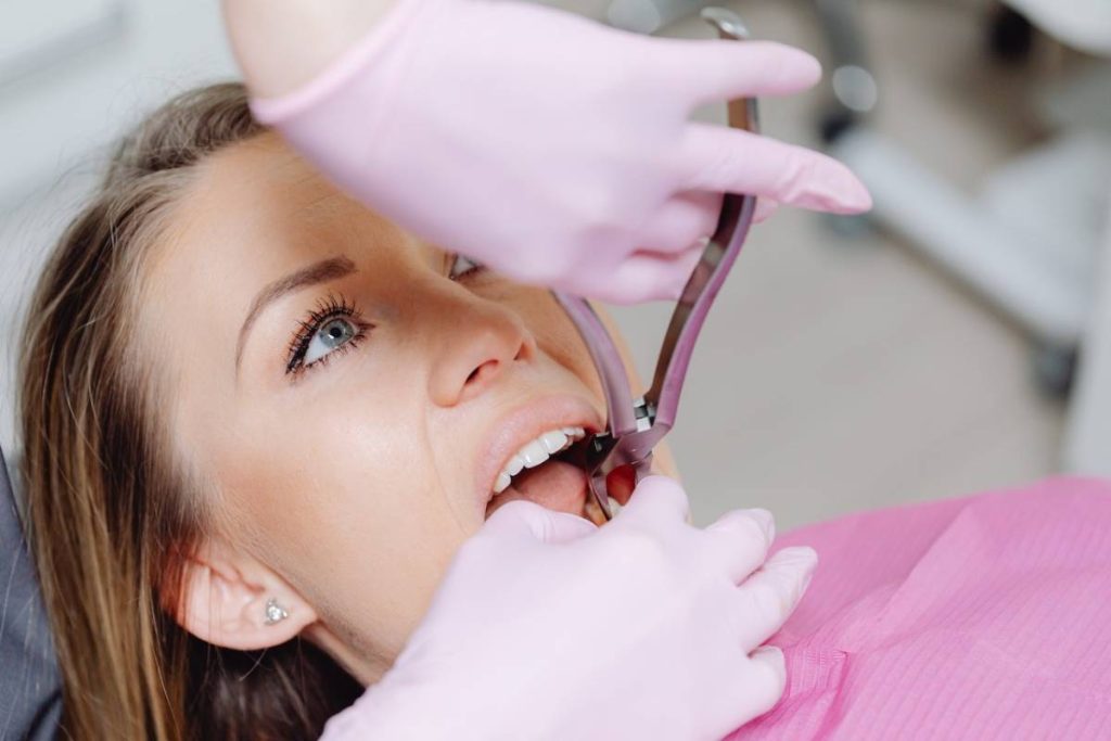 Dental Extraction