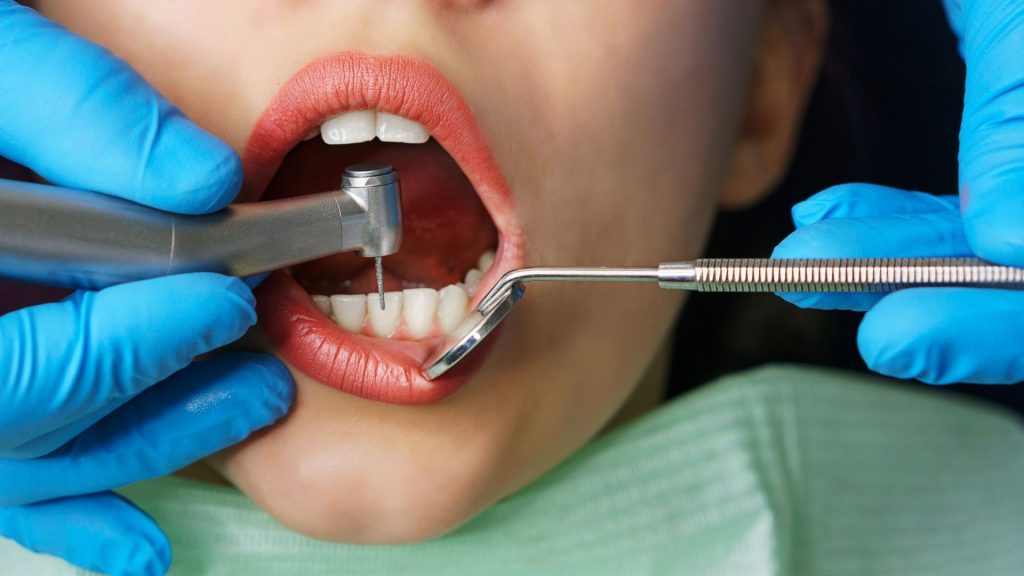 Dental Procedure