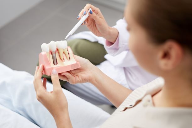dental impant model
