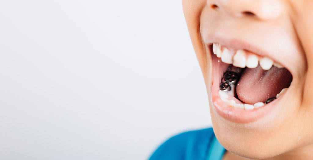 Channel Islands Family Dental Office | Dentist In Ventura County