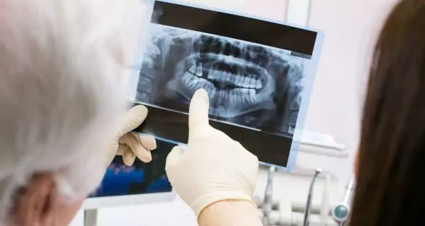 Step 1: exam and X-rays