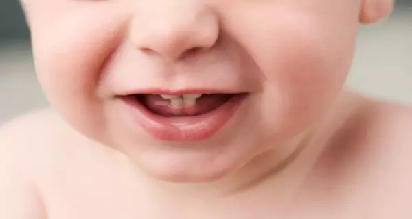 ¿Por qué los niños rechinan sus dientes?