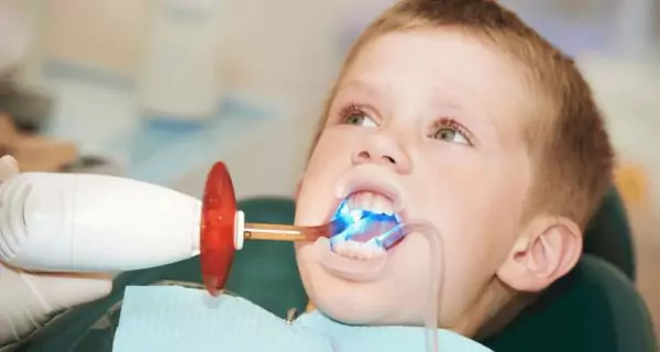 What treatments are available for cavities in children?