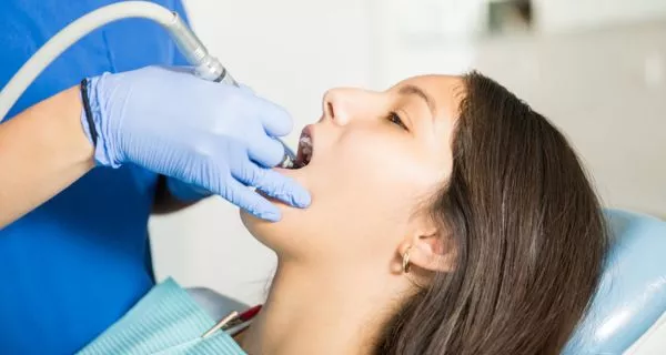 1. What is a routine cleaning (prophylaxis)?