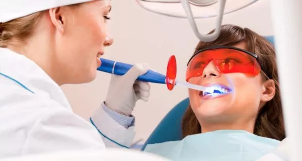 How dentists treat advanced cavities