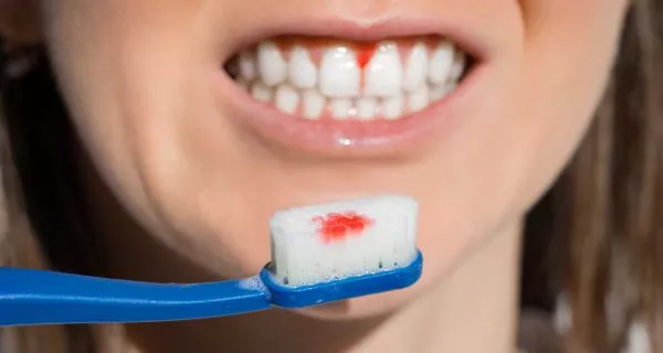 How do hormones affect women’s oral health?