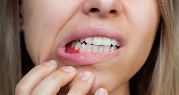 ¿Qué pasa si no cambias tu cepillo de dientes?