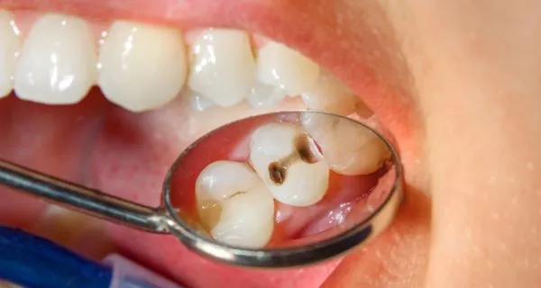 Why is maintaining good oral hygiene so important?