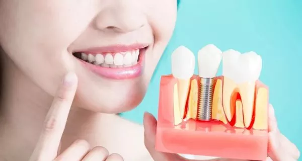 ¿Qué opciones existen para reemplazar los dientes perdidos?