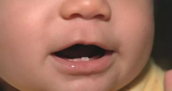 When do toddler teeth erupt?
