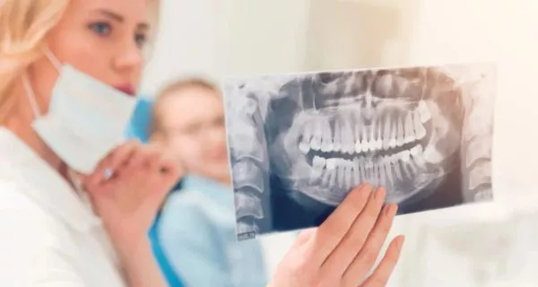 Are dental X-rays safe?