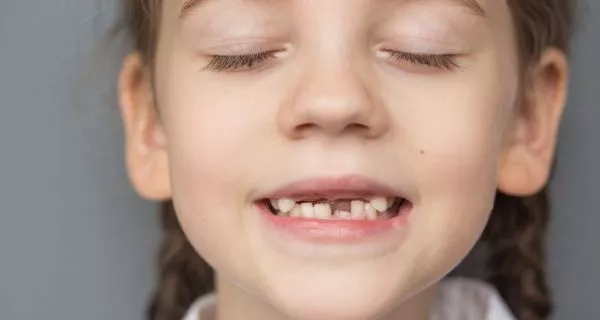 Do permanent teeth come in without others falling out?