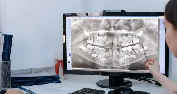 Periapical X-rays vs. panoramic X-rays: what’s the difference?